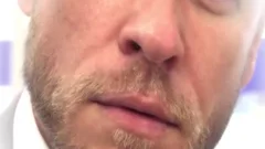 Bearded pound 5