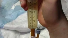 I insert A 24 French Catheter In Me. I Take In 500 ML Of Water In My Bladder. WhelLOLe My Bladder Is To The Bursting Point Play With Myself To The Poi