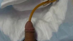 I insert A 24 French Catheter In Me. I Take In 500 ML Of Water In My Bladder. WhelLOLe My Bladder Is To The Bursting Point Play With Myself To The Poi