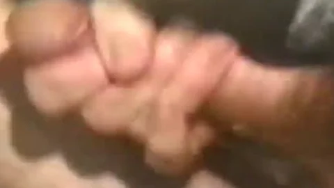 Hair Plug - Scene 2