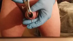 First Transurethral With 10ga Needle