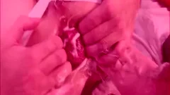 FISTCODE